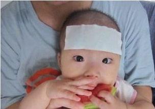 宝宝吃瓜后发烧